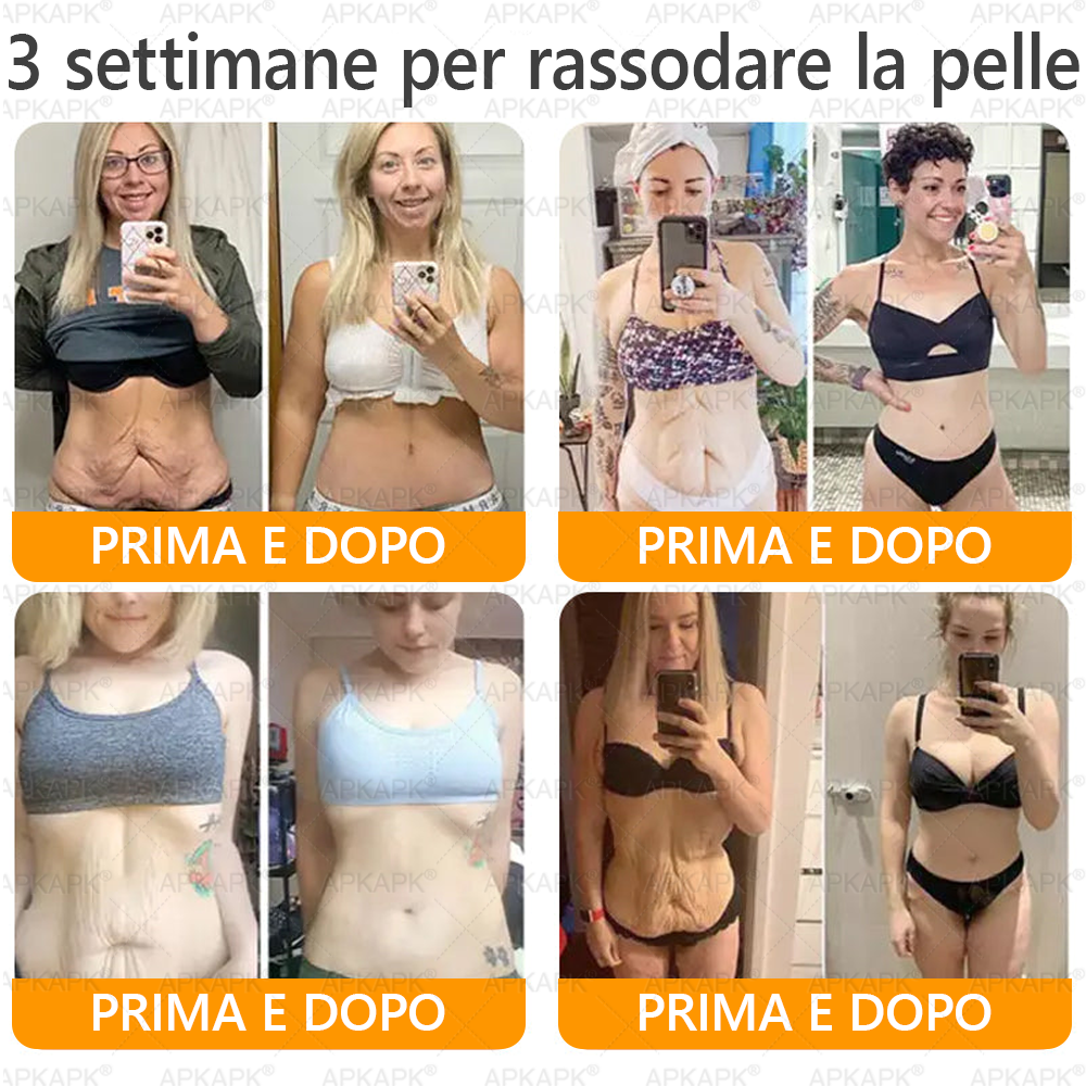 Prodotto e spedito in Italia 🫧 𝖠𝖯𝖪𝖠𝖯𝖪® Crema Ripristino Pelle al Veleno d'Api
