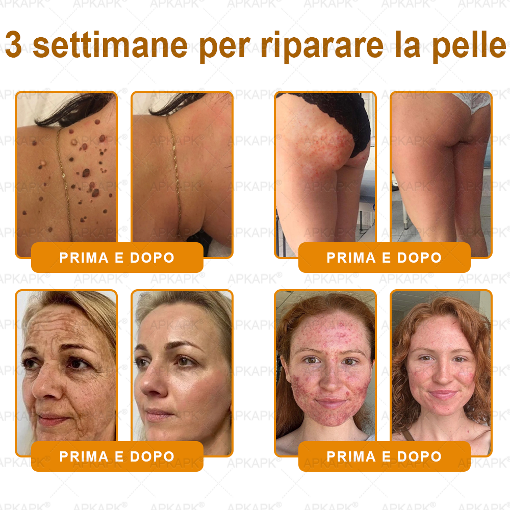 Prodotto e spedito in Italia 🫧 𝖠𝖯𝖪𝖠𝖯𝖪® Crema Ripristino Pelle al Veleno d'Api