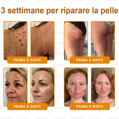 Prodotto e spedito in Italia 🫧 𝖠𝖯𝖪𝖠𝖯𝖪® Crema Ripristino Pelle al Veleno d'Api