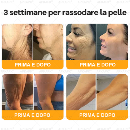 Prodotto e spedito in Italia 🫧 𝖠𝖯𝖪𝖠𝖯𝖪® Crema Ripristino Pelle al Veleno d'Api