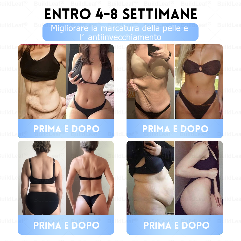 Clinicamente testato · Cerotto a microaghi nano BuildLeaf® Slim & Firm con Moringa, Omega-3, Peptidi di Collagene, NAD e NMN per obesità, salute cardiovascolare, diabete, apnea notturna, articolazioni, pelle e anti-età.