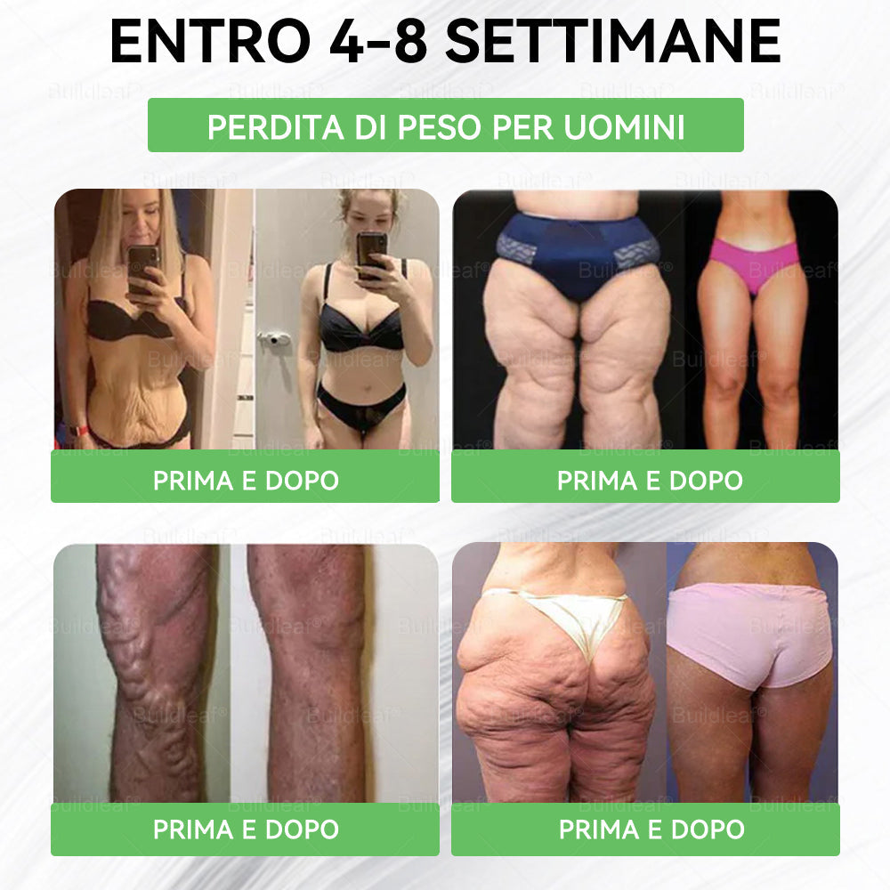 ⏰ Solo pochi pacchi rimasti in magazzino! Approfitta subito di un extra 30% di sconto! Un corpo più snodato e più energia sono a portata di mano! Se lo perdi questa volta, dovrai aspettare fino all’anno prossimo per la prossima occasione! ⏰ 𝑩𝒖𝐢𝒍𝒅𝑳𝒆𝐚𝒇®