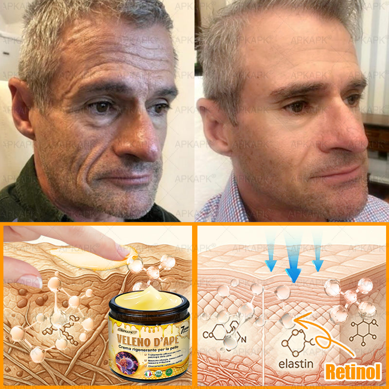 Prodotto e spedito in Italia 🫧 𝖠𝖯𝖪𝖠𝖯𝖪® Crema Ripristino Pelle al Veleno d'Api