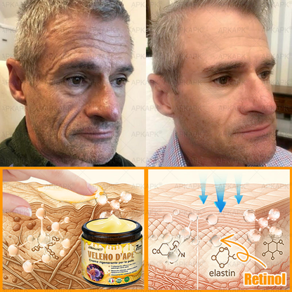 Prodotto e spedito in Italia 🫧 𝖠𝖯𝖪𝖠𝖯𝖪® Crema Ripristino Pelle al Veleno d'Api