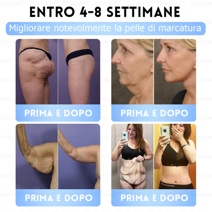 Clinicamente testato · Cerotto a microaghi nano BuildLeaf® Slim & Firm con Moringa, Omega-3, Peptidi di Collagene, NAD e NMN per obesità, salute cardiovascolare, diabete, apnea notturna, articolazioni, pelle e anti-età.
