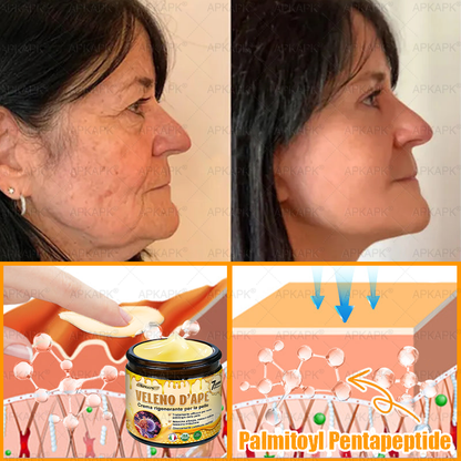 Prodotto e spedito in Italia 🫧 𝖠𝖯𝖪𝖠𝖯𝖪® Crema Ripristino Pelle al Veleno d'Api