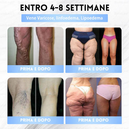 Clinicamente testato · Cerotto a microaghi nano BuildLeaf® Slim & Firm con Moringa, Omega-3, Peptidi di Collagene, NAD e NMN per obesità, salute cardiovascolare, diabete, apnea notturna, articolazioni, pelle e anti-età.