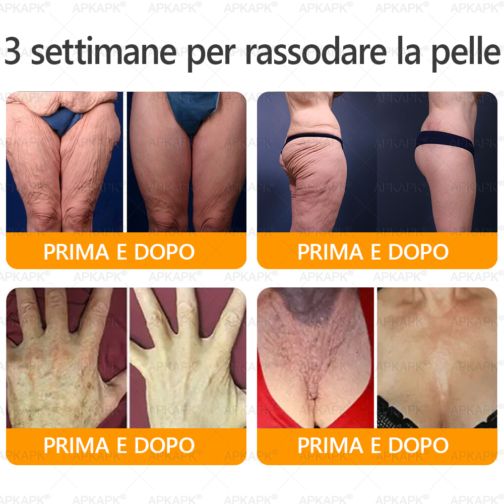 Prodotto e spedito in Italia 🫧 𝖠𝖯𝖪𝖠𝖯𝖪® Crema Ripristino Pelle al Veleno d'Api